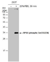 Anti Rps Phospho Ser Antibody Gtx Genetex