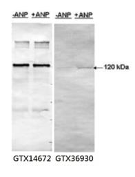 Anti Pde A Phospho Ser Antibody Gtx Genetex