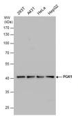 Anti-PGK1 antibody used in Western Blot (WB). GTX107614