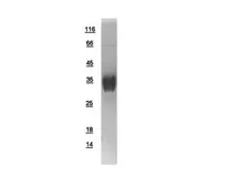 Human Aspartoacylase protein, His tag. GTX110699-pro