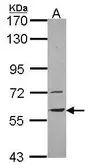 Anti-Vanin 1 antibody [N3C3] used in Western Blot (WB). GTX114212