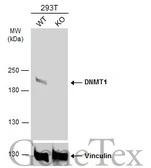 Anti-DNMT1 antibody [N1], N-term used in Western Blot (WB). GTX116011