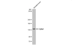 Anti-Cyfip2 antibody used in Western Blot (WB). GTX124387