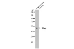 Anti-Gfap antibody used in Western Blot (WB). GTX128741