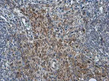 Anti-PRRS virus M protein antibody used in IHC (Paraffin sections) (IHC-P). GTX129063