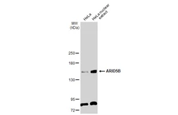 Anti-ARID5B antibody used in Western Blot (WB). GTX131249