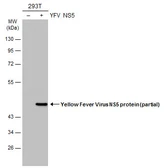 Anti-Yellow Fever virus NS5 protein antibody used in Western Blot (WB). GTX134141