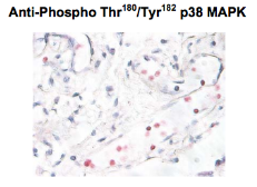 Anti P Mapk Phospho Thr Tyr Antibody Gtx Genetex