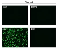 Anti-Japanese encephalitis virus NS1 antibody [GT1410] used in Immunocytochemistry/ Immunofluorescence (ICC/IF). GTX633820