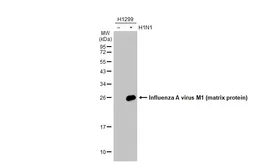 Anti-Influenza A virus M1 (matrix protein) antibody [HL1273] used in Western Blot (WB). GTX636675