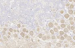 Anti-PKC (pan) (zeta phospho Thr410) antibody [HL1279] used in IHC (Paraffin sections) (IHC-P). GTX636681