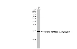 Anti-Histone H3K18ac (Acetyl Lys18) antibody [HL1463] used in Western Blot (WB). GTX636937