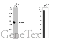 Anti-HHIP antibody [HL1969] used in Western Blot (WB). GTX637862