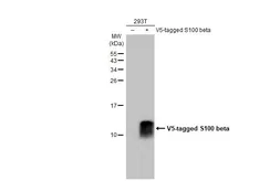 Anti-S100 beta antibody [HL2228] used in Western Blot (WB). GTX638273