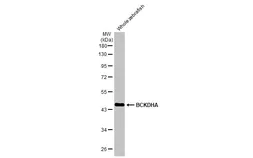 Anti-BCKDHA antibody [HL2434] used in Western Blot (WB). GTX638750
