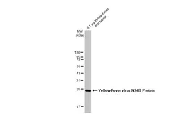 Anti-Yellow Fever virus NS4B Protein antibody [HL2449] used in Western Blot (WB). GTX638767