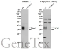 Anti-TIGIT antibody [HL2655] used in Western Blot (WB). GTX639114