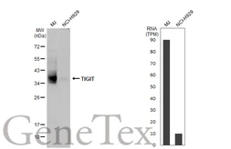 Anti-TIGIT antibody [HL2657] used in Western Blot (WB). GTX639116