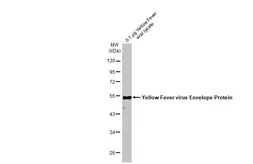 Anti-Yellow Fever virus Envelope Protein antibody [HL2730] used in Western Blot (WB). GTX639558
