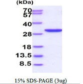 Human PGAM2 protein, His tag. GTX67631-pro