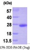 Human PTP4A3 protein, His tag. GTX68229-pro