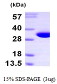Human NIT2 protein, His tag. GTX68643-pro