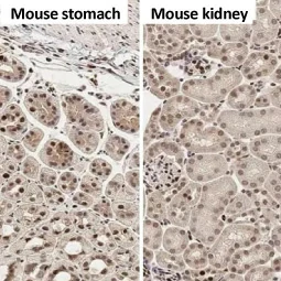 PCNA antibody [HL1965] (GTX637858)