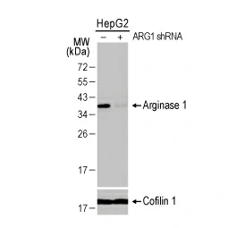 Arginase 1 antibody [HL1891] (GTX637640)