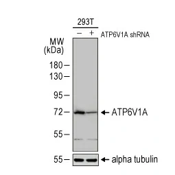 ATP6V1A antibody (GTX110815)