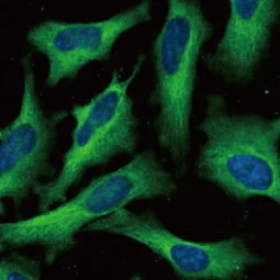 Fatty Acid Synthase antibody [HL2161] (GTX638139)