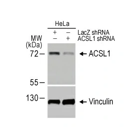 ACSL1 antibody [HL1651] (GTX637232)