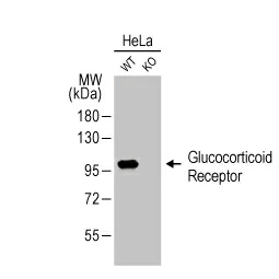 Glucocorticoid Receptor antibody [HL1151] (GTX636422)