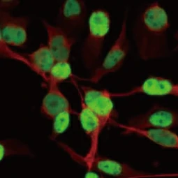 MyoD1 antibody [HL1372] (GTX636812)