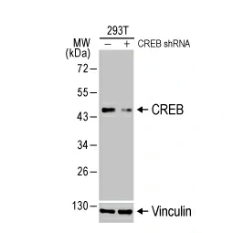 LC3B antibody [GT1187] (GTX00949)