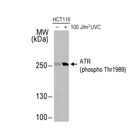 ATR (phospho Thr1989) antibody (GTX128145)