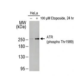 ATR (phospho Thr1989) antibody [HL1836] (GTX637561)