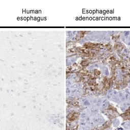 PD-L1 antibody [HL1041] (GTX635975)