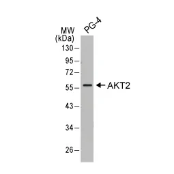 AKT2 antibody (GTX128457)