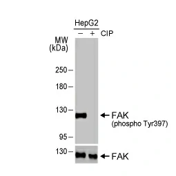 FAK (phospho Tyr397) antibody (GTX129840)