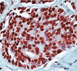 Cardiac Troponin T antibody [1C11] GTX28295