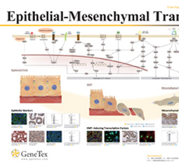 Epithelial-Mesenchymal Transition poster