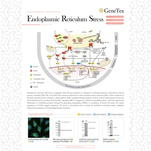 Endoplasmic Reticulum Stress