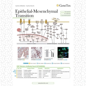 Epithelial-Mesenchymal Transition