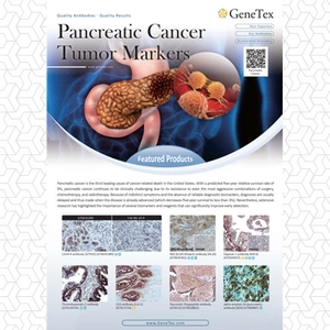 Pancreatic Cancer Tumor Markers