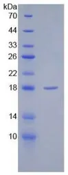 Rat SFRP1 protein, His tag (active). GTX00065-pro