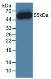 Human FGF1 protein, His and GST tag (active). GTX00081-pro