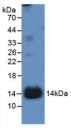 Human IL1 Receptor 1 protein, His tag. GTX00091-pro