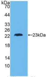 Human TNF beta protein, His tag (active). GTX00103-pro