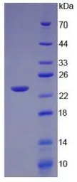 Human TNF beta protein, His tag (active). GTX00103-pro