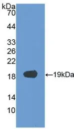 Human VEGF165 protein, His tag. GTX00110-pro